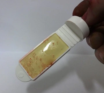 A dip slide speckled with small red dots of bacteria