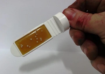 A dip slide with small, round, white discs of yeast on its agar
