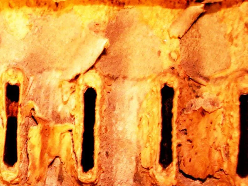 Inside the radiator's top tank before cleaning: oxide and mineral scale deposits crusted around the tube openings, restricting the coolant flow and causing overheating